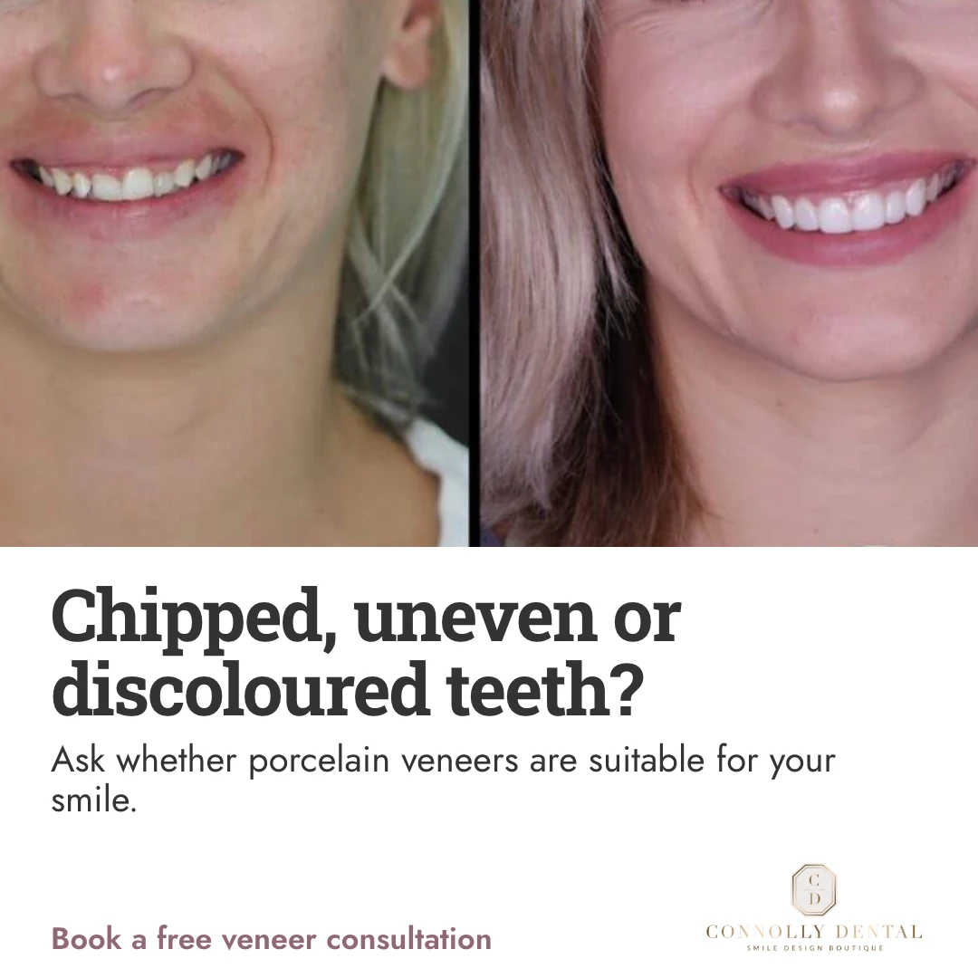 The chipped tooth that catches your eye ad creative