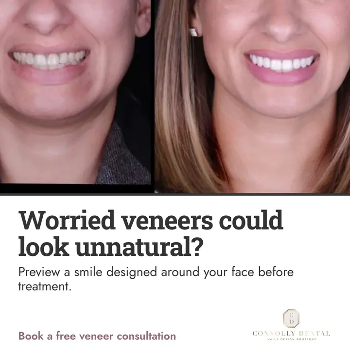 Second finished Connolly Dental Boutique image ad