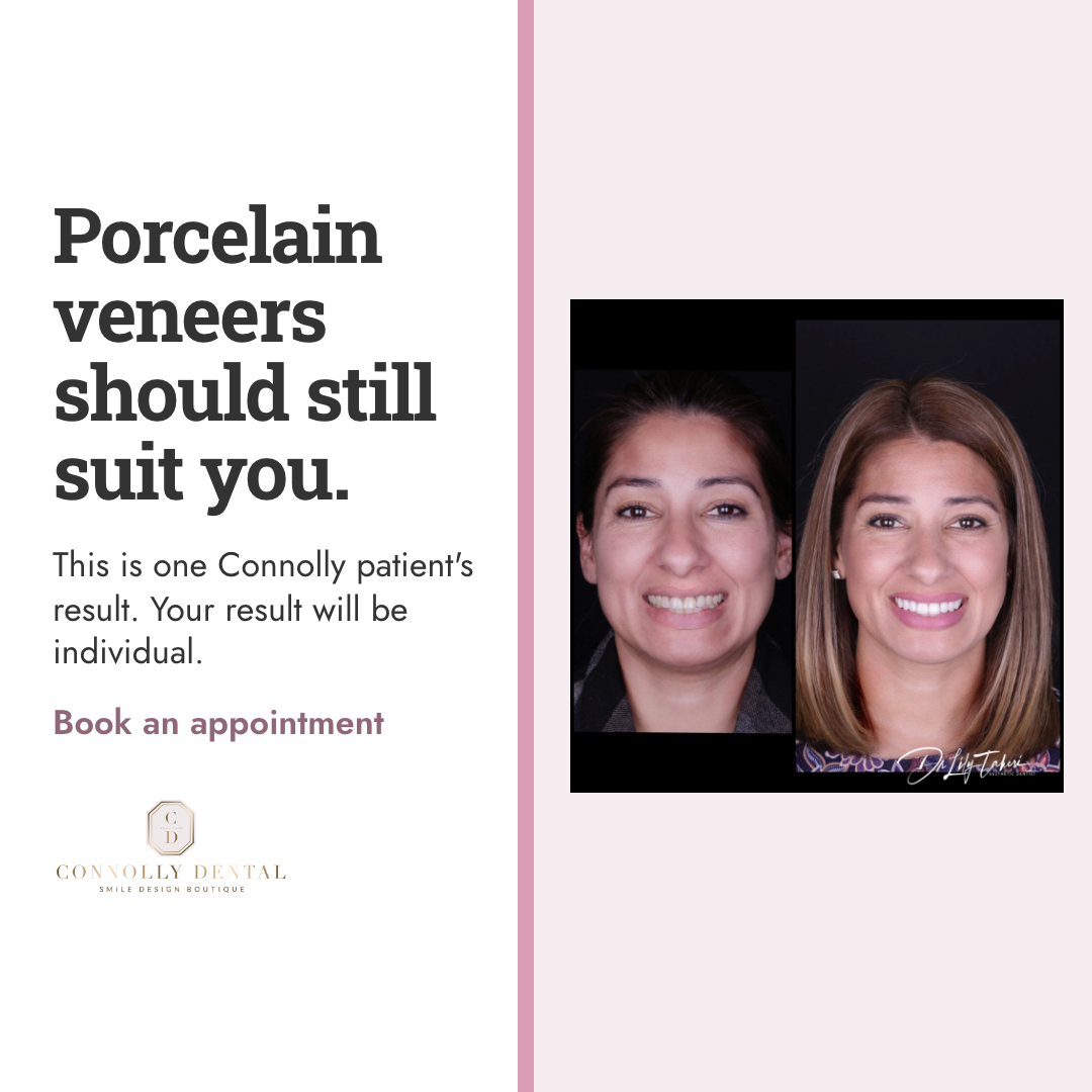 Second finished Connolly Dental Boutique image ad